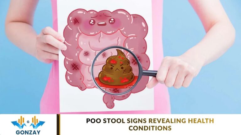 Poo Stool Signs Revealing Health Conditions Poo Stool Signs Revealing Health Conditions